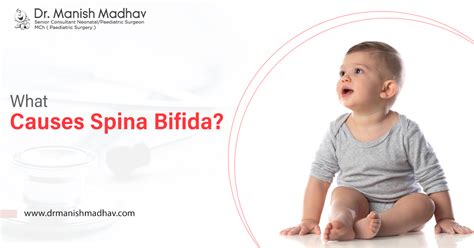 bufuda|Spina bifida causes, symptoms and treatment